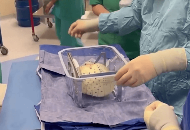 Implantan con éxito un corazón artificial total en Jerusalén