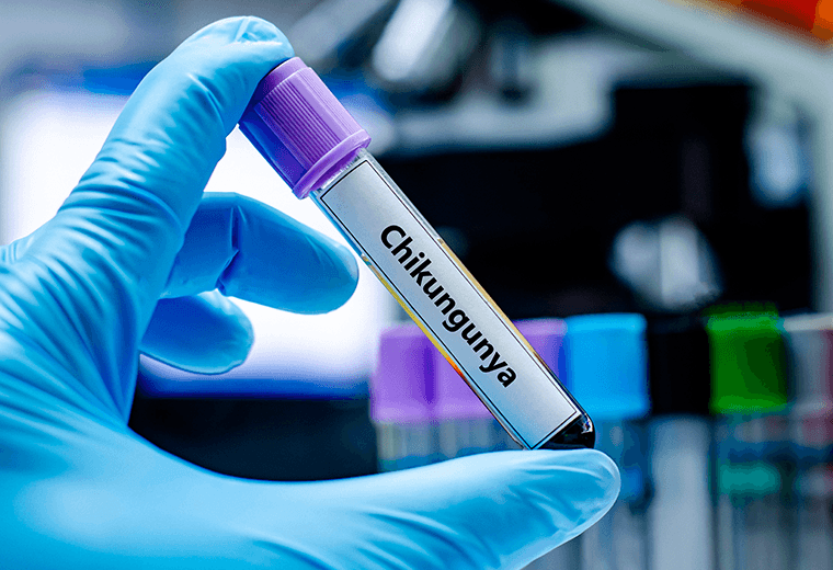 Salud ha descartado 39 casos sospechosos de chikungunya