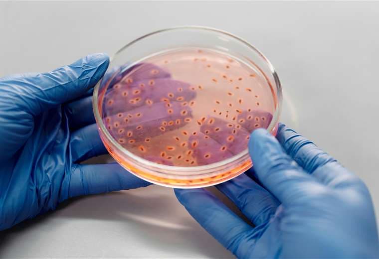 ¿Qué es la salmonella? Estas son las formas de contagio y cómo prevenirla
