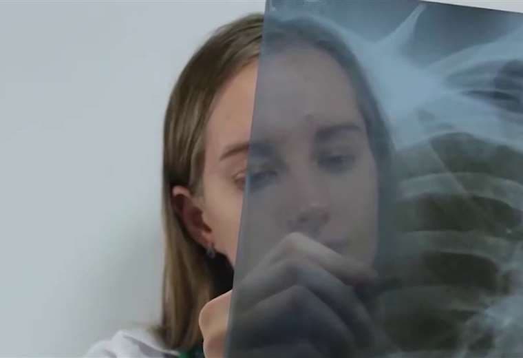 85% de los casos de cáncer de pulmón se detectan tarde